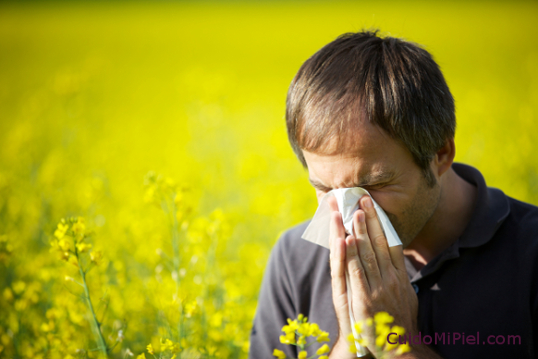 Alergias en la Piel